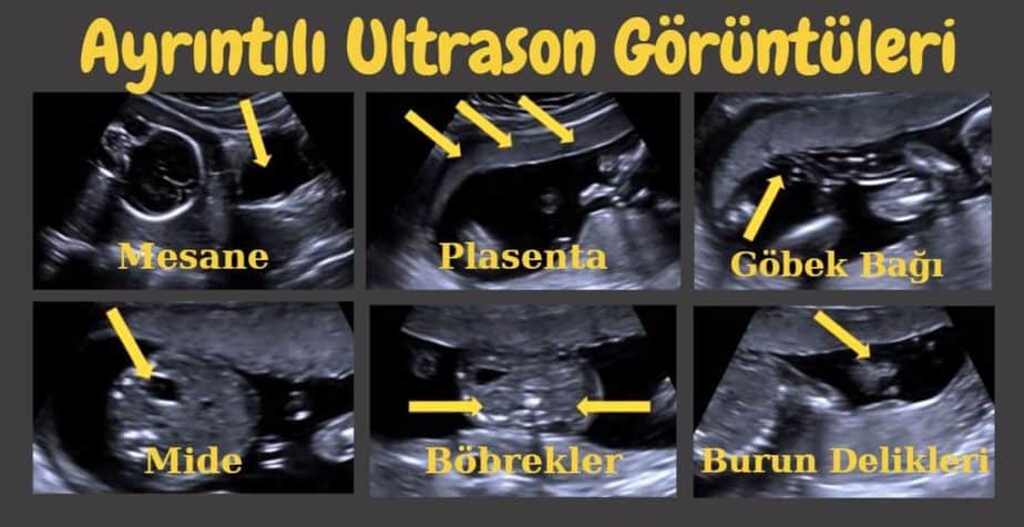 ayrıntılı ultrason görüntüleri