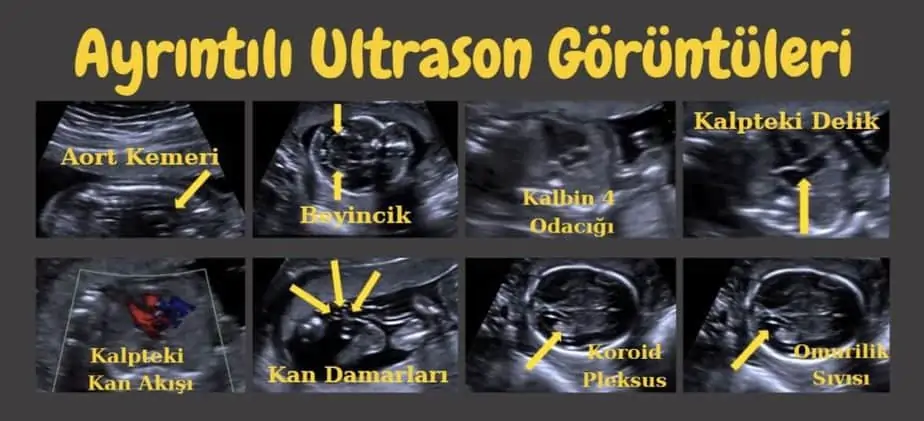 detaylı ultrason ankara