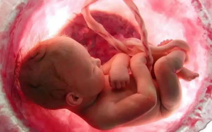 erkek bebek kesesi ultrason