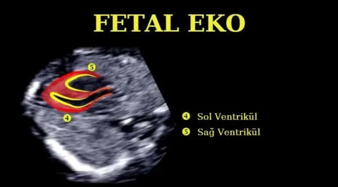 fetal eko