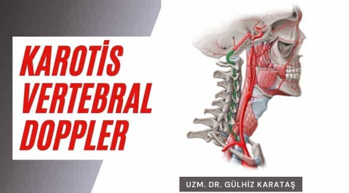 karotis vertebral doppler