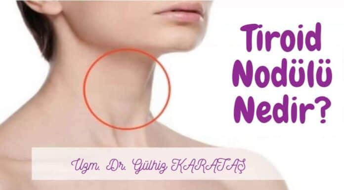 tiroid nodulu nedir