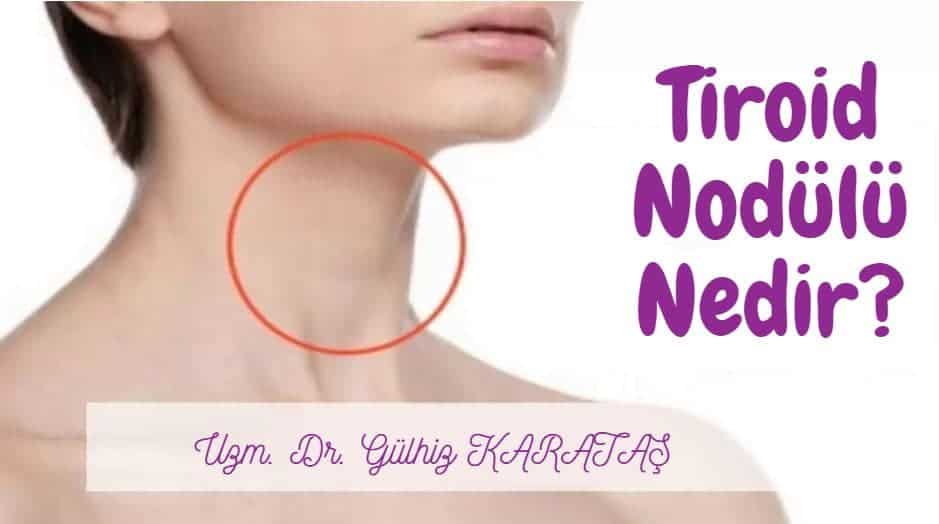 tiroid nodulu neden olur uzm dr gulhiz karatas